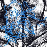 Nella Placenta Lug 93