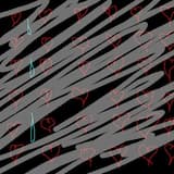 Tension dans mes terminaisons nerveuses