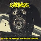 Eaten Alive (Necrotizing Fasciitis)