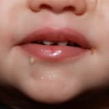 An Awkward Moment With a Grilled Cheese Sandwich